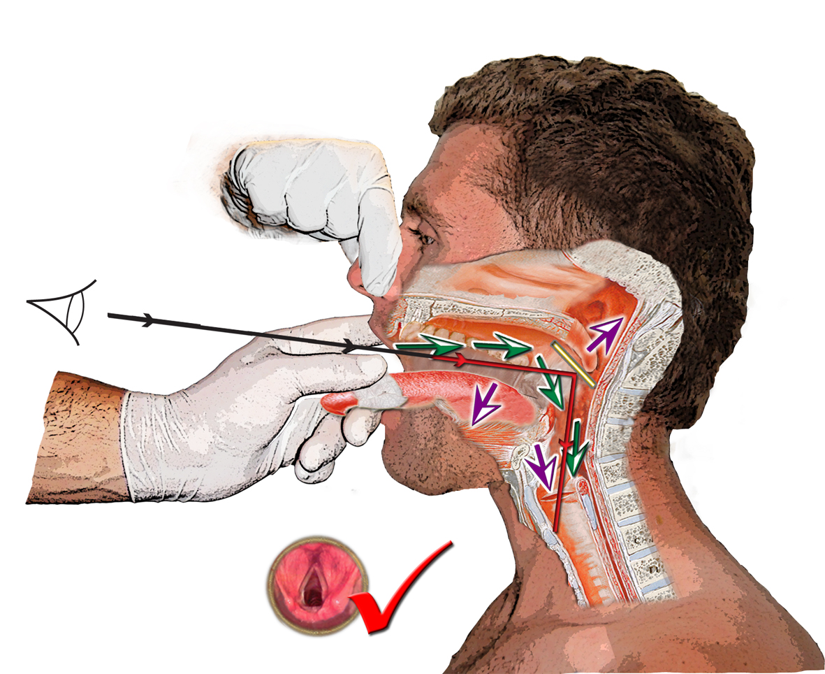 Fig 3